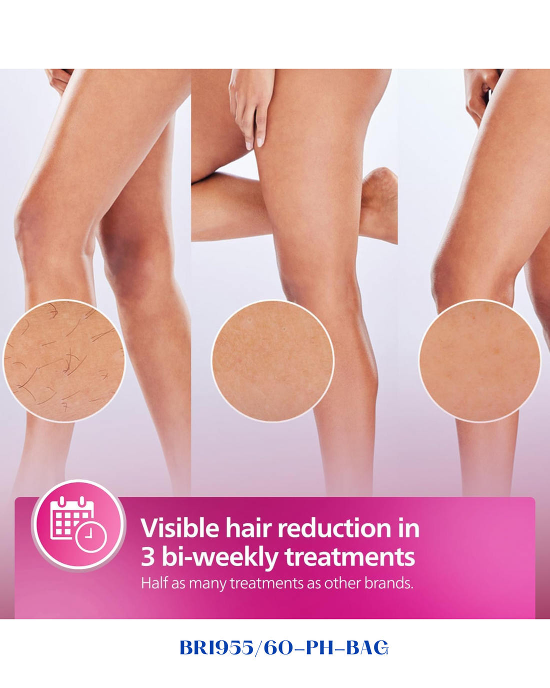 PHILIPS LUMEA IPL 9000 SERIES HAIR REMOVAL DEVICE WITH SENSEIQ